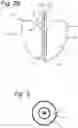Fig. 03 - HEART ASSIST DEVICE