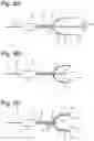 Fig. 06 - HEART ASSIST DEVICE