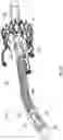 Fig. 24 - MECHANICAL CIRCULATORY SUPPORT SYSTEM WITH GUIDEWIRE AID