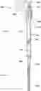 Fig. 01 - PURGELESS MECHANICAL CIRCULATORY SUPPORT SYSTEM WITH MAGNETIC DRIVE