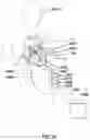 Fig. 24 - PURGELESS MECHANICAL CIRCULATORY SUPPORT SYSTEM WITH MAGNETIC DRIVE