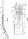 Fig. 09 - MECHANICAL CIRCULATORY SUPPORT SYSTEM WITH INSERTION TOOL