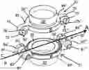 Fig. 01 - A VASCULAR COUPLING DEVICE