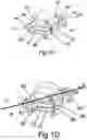 Fig. 03 - A VASCULAR COUPLING DEVICE