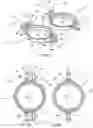 Fig. 04 - A VASCULAR COUPLING DEVICE