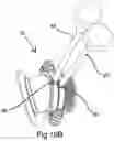 Fig. 14 - A VASCULAR COUPLING DEVICE