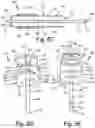 Fig. 09 - Electrode contact for a subcutaneous device