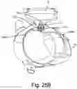 Fig. 41 - Electrode contact for a subcutaneous device
