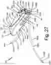 Fig. 43 - Electrode contact for a subcutaneous device