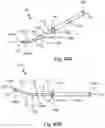 Fig. 75 - Electrode contact for a subcutaneous device