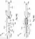 Fig. 82 - Electrode contact for a subcutaneous device