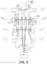Fig. 08 - METHODS AND SYSTEMS FOR IMPLANTING A NEUROMODULATION SYSTEM AT A SURGICALLY OPEN SPINAL TREATMENT SITE