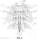 Fig. 11 - METHODS AND SYSTEMS FOR IMPLANTING A NEUROMODULATION SYSTEM AT A SURGICALLY OPEN SPINAL TREATMENT SITE