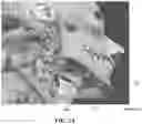 Fig. 03 - Implantable electrodes with remote power delivery for treating sleep apnea, and associated systems and methods