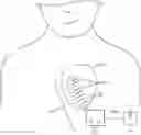 Fig. 01 - Devices, systems, and methods for cardiac resynchronization therapy