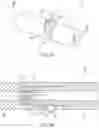 Fig. 06 - Bulkhead anchor for medical device leads
