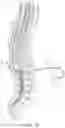 Fig. 03 - Slip ring anchor