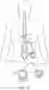 Fig. 04 - Slip ring anchor