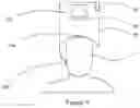 Fig. 07 - SYSTEMS AND METHODS FOR PROVIDING TREATMENT TO THE BRAIN USING MAGNETIC FIELD THERAPY