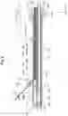 Fig. 07 - CATHETER AND LIGHT IRRADIATION SYSTEM