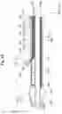 Fig. 15 - CATHETER AND LIGHT IRRADIATION SYSTEM