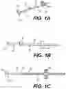 Fig. 02 - Modular brachytherapy applicator