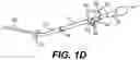 Fig. 03 - Modular brachytherapy applicator
