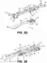 Fig. 08 - Modular brachytherapy applicator