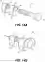 Fig. 25 - Modular brachytherapy applicator