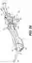 Fig. 30 - Modular brachytherapy applicator