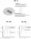 Fig. 13 - Systems and methods for automatic treatment planning and optimization