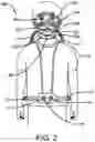 Fig. 03 - Personal protective facemask system