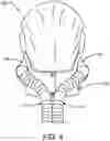 Fig. 05 - Personal protective facemask system