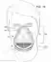 Fig. 15 - Respiratory face mask for improved communications