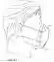 Fig. 20 - Respiratory face mask for improved communications