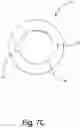 Fig. 15 - Jump rope device with removably-connected cable and improved bearing assembly therefor