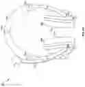 Fig. 05 - Hearing device with age detection