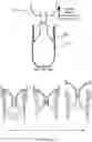 Fig. 19 - Method and system for buoyant separation