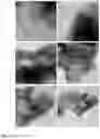 Fig. 05 - Method for obtaining metal oxides supported on mesoporous silica particles