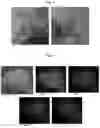 Fig. 04 - CO-DEFLAGRATION SYNTHESIS OF METALLIC, CERAMIC, AND MIXED CERAMIC-METALLIC PARTICLES
