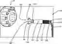 Fig. 01 - Device for unclogging pumps and pipes
