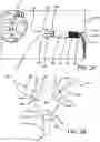 Fig. 04 - Device for unclogging pumps and pipes