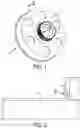 Fig. 02 - Dissimilar metal laser welding