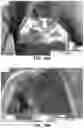Fig. 27 - MULTI-MATERIAL, MULTI-LAYERED FEMTOSECOND LASER SURFACE PROCESSING