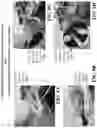 Fig. 20 - Multi-tentacular soft robotic grippers
