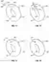 Fig. 04 - Inflatable device repair kit