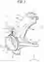 Fig. 02 - Vehicle knuckle