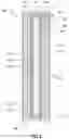 Fig. 03 - Composite truck body kits