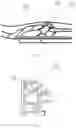 Fig. 05 - TRASH BAG FITTING DEVICE, TRASH BAG DETECTION DEVICE, SMART TRASH RECEPTACLE AND METHOD FOR CONTROL OF AUTOMATIC BAG REPLACEMENT