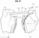 Fig. 13 - Conveyor transfer guards